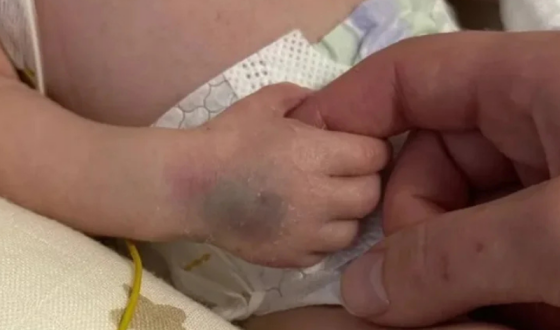 Новонародженого сина жінки, яка загинула під час обстрілу Києва, виписують із лікарні