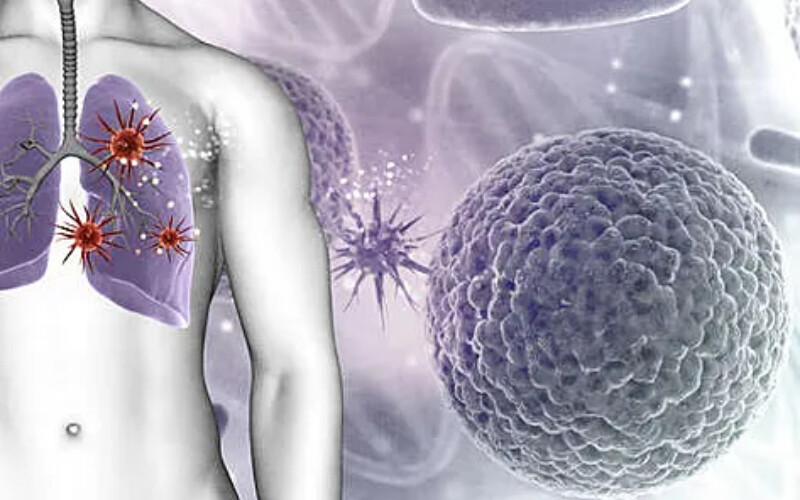 Вчені запропонували використовувати бактеріальні токсини в лікуванні раку легень