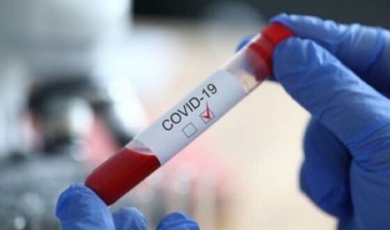 У ЛНР вірусом COVID-19 заразилися 542 особи