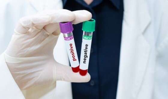 Польща безкоштовно робитиме тести на коронавірус українським заробітчанам