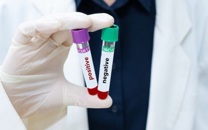 Польща безкоштовно робитиме тести на коронавірус українським заробітчанам