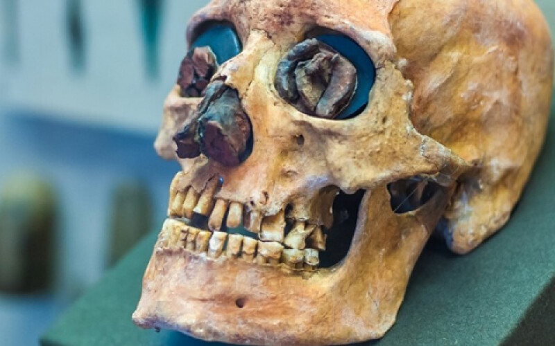 В зубах древнего человека нашли вирус гепатита В