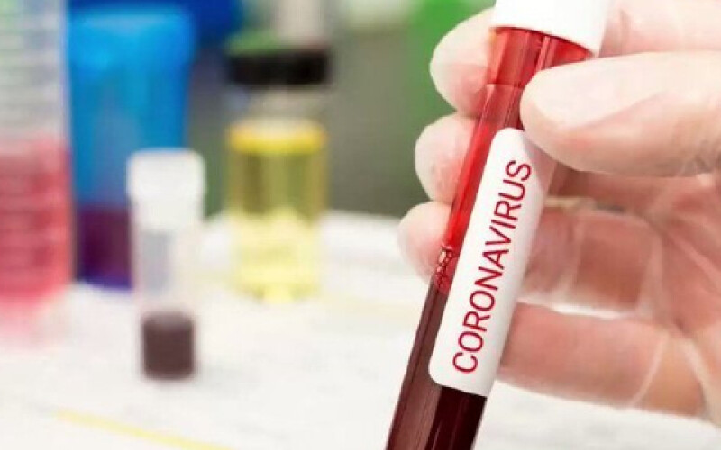 Вакцина проти нового вірусу COVID-19 може бути доступна через 90 днів