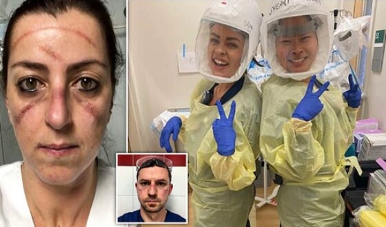 Лікарі показали, як виглядають їхні обличчя після доби роботи в умовах пандемії COVID-19