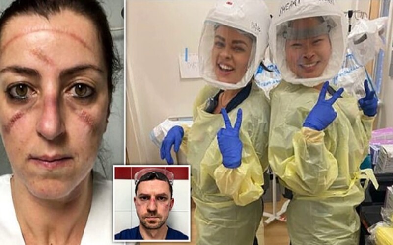 Лікарі показали, як виглядають їхні обличчя після доби роботи в умовах пандемії COVID-19