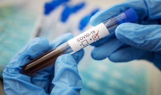 В Україні використувують російські тести для коронавірусу