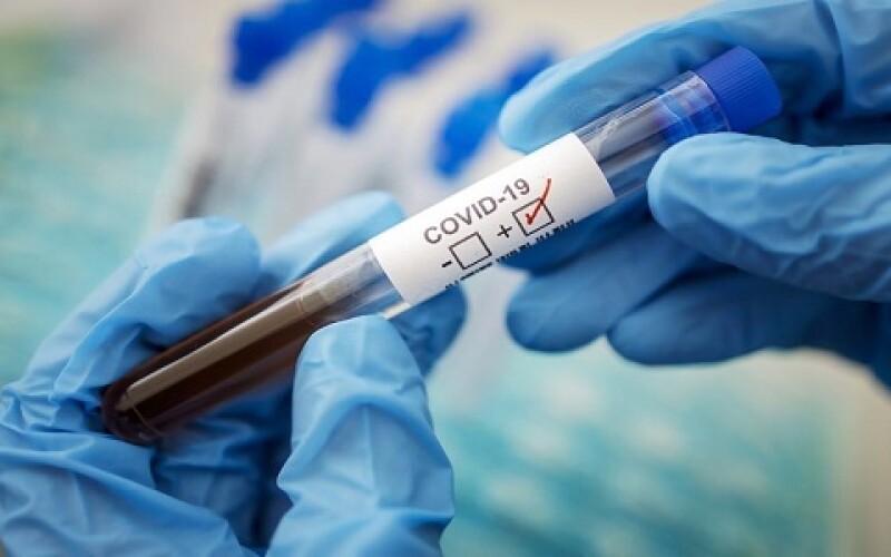 Ученый рассказал о людях, невосприимчивых к коронавирусу