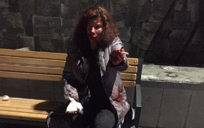 У Києві вночі жінку жорстоко побили через те, що вона розмовляла російською
