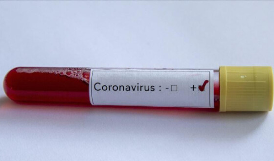 У Німеччині починається епідемія нового вірусу COVID-19