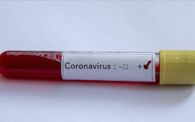 В Україні лабораторно підтверджено 16 випадків COVID-19