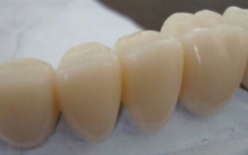 Украинец попытался вывезти из России почти 1000 зубов
