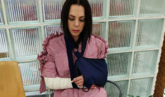 Соня Кай неудачно упала и повредила руки