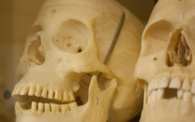 В Италии сотрудники кладбища относили черепа в ломбард