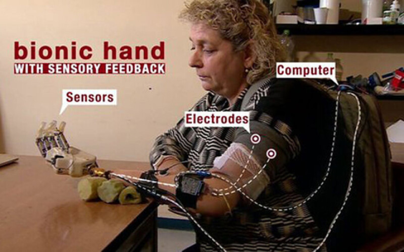 В Италии появилась первая женщина с бионической рукой