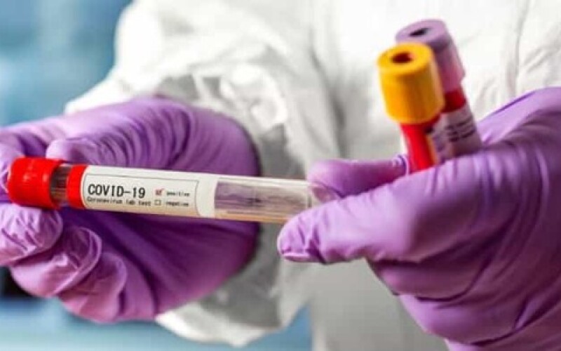 У США немає доказів, що вірус COVID-19 було створено у китайських лабораторіях