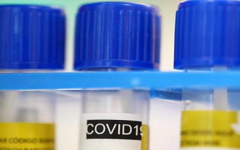 Новий штам коронавірусу &#8220;омікрон&#8221; виявлено вже у третині американських штатів