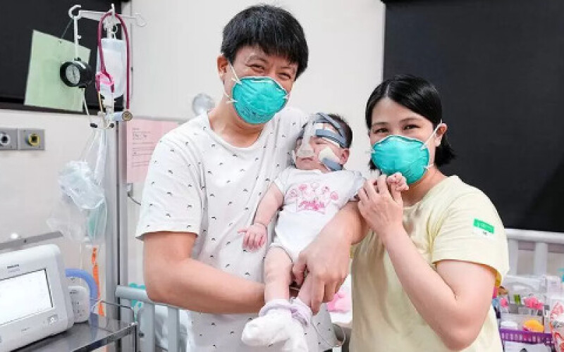 У Сінгапурі лікарі врятували немовля, яке з&#8217;явилося на світ на 25-му тижні вагітності