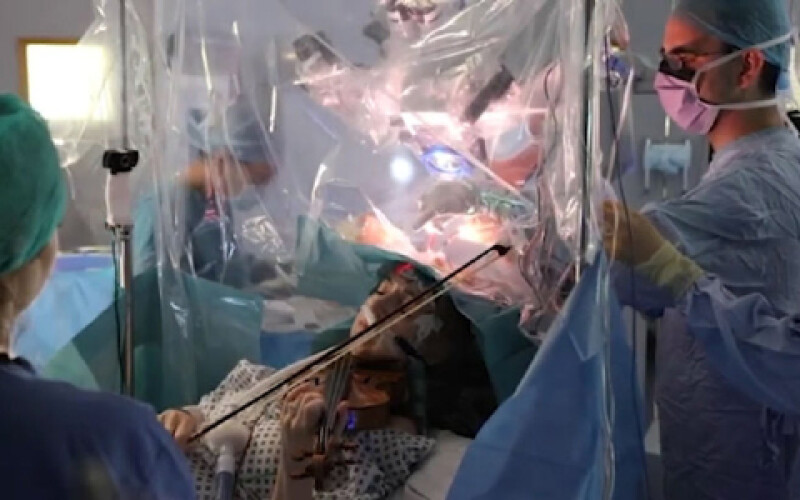 У Лондоні провели операцію на мозку, під час якої пацієнтка грала на скрипці. Відео
